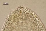 6 - Cellula apicale